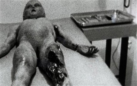 Alien Autopsy Depiction