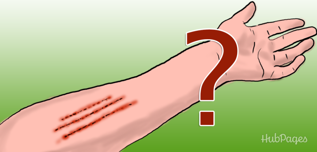 Scratches on Arm