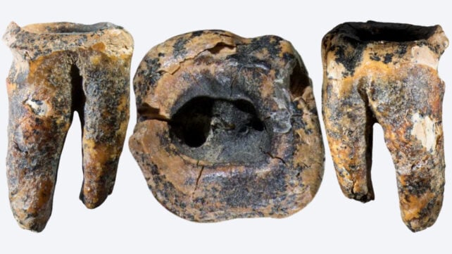 Neanderthal root canal 