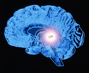 Pineal Gland
